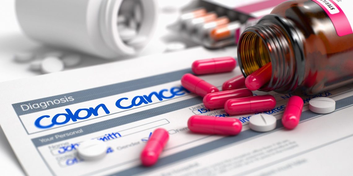 Cancer, The Immune System, and Nutritional Supplements.