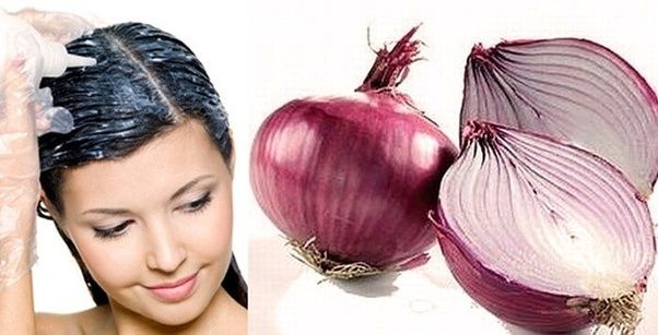 Can Onion juice do for hair growth?