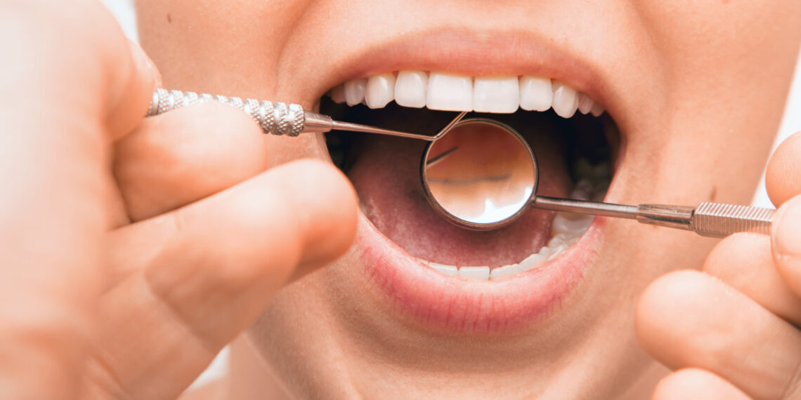 Here's Why the Bumps on Your Gums Are Not Going Away