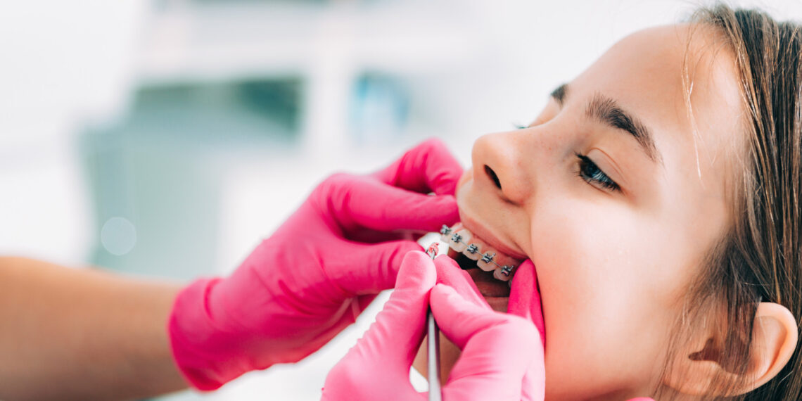How to Find an Orthodontist: 5 Tips for a Great Match