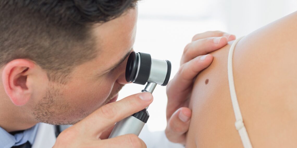 Skin Cancer: 5 Reasons to Consider Mohs Surgery