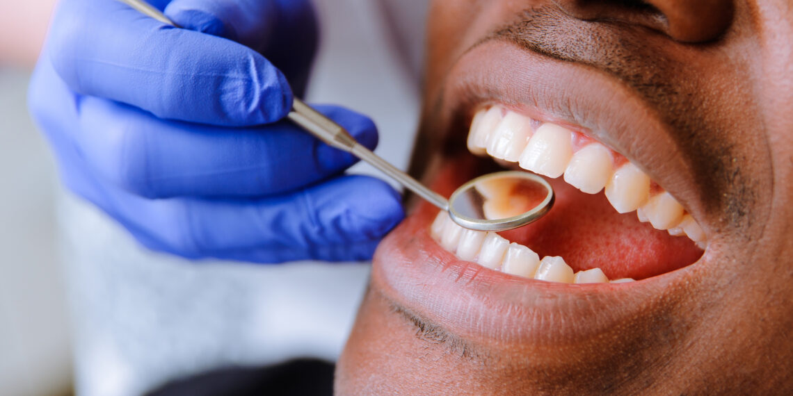 Root Canal vs Crown: What Is the Difference?