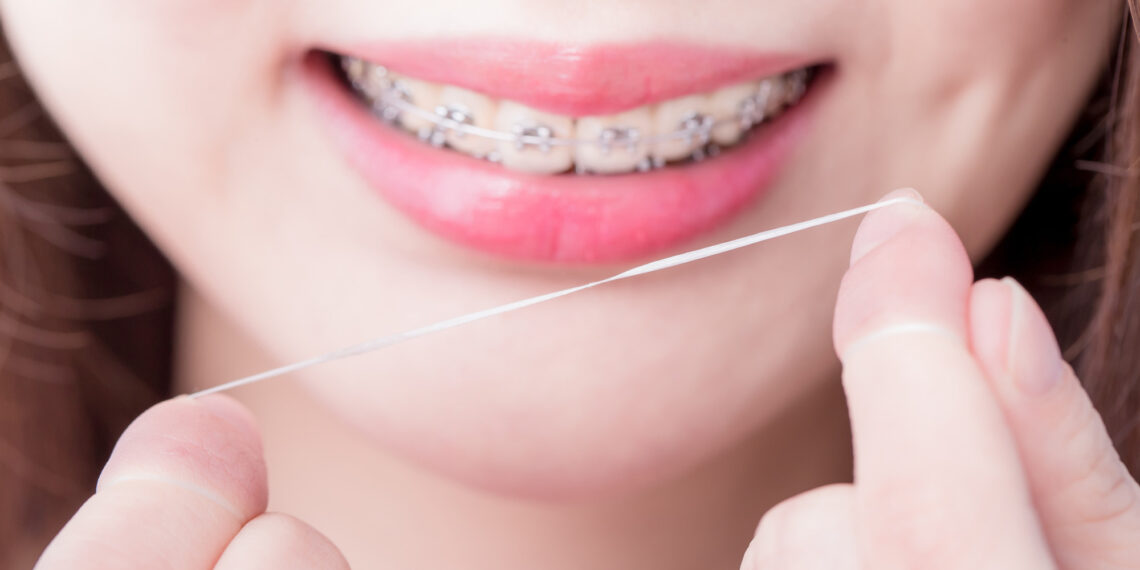 5 Flossing Tips to Keep Your Gums Healthy