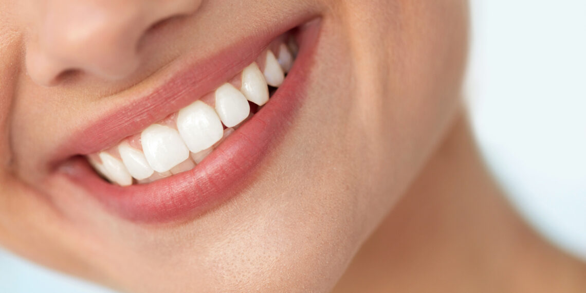 Restoring Your Smile The Benefits of Wearing Dentures