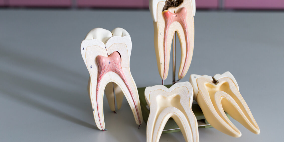 The Average Cost of a Root Canal: A Detailed Guide
