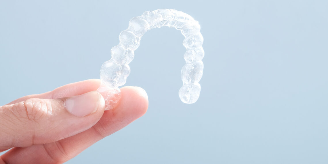 Where Is the Best Invisalign Provider Near Me?: 9 Secrets to Choosing the Perfect One