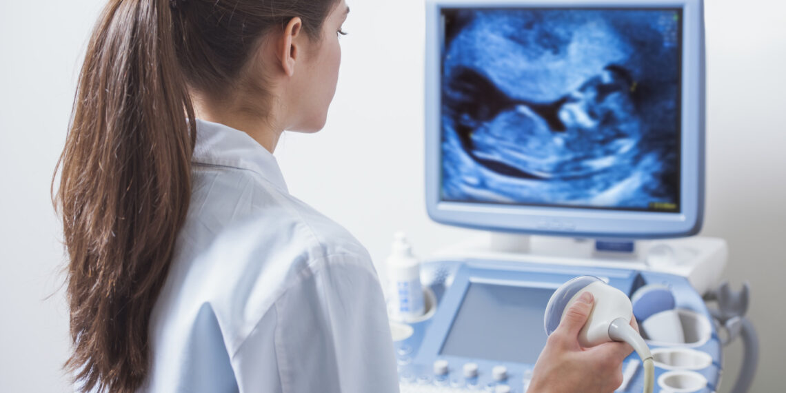 How to Read Ultrasound Pictures