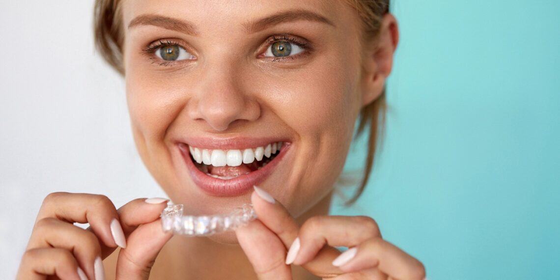 The Average Cost of Invisalign: A Detailed Price Guide