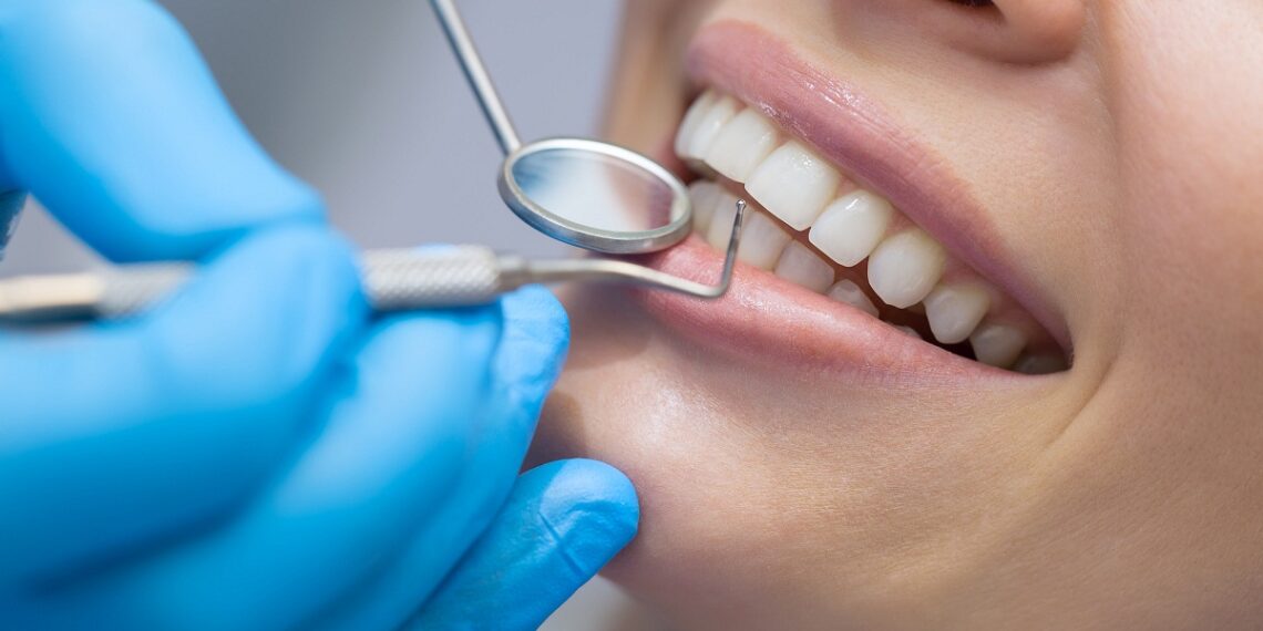 What Are the Different Kinds of Dental Services?