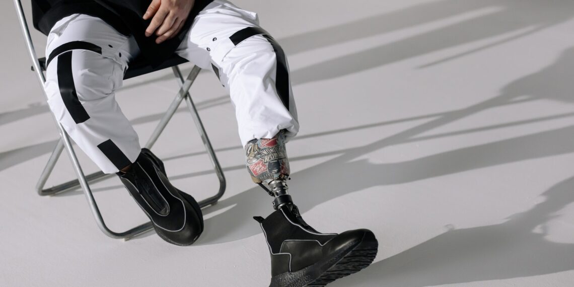 4 Care Tips for Keeping a Prosthetic Limb in Pristine Condition