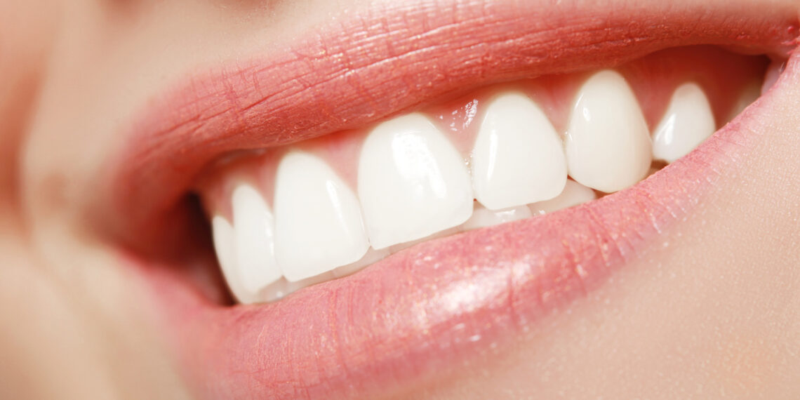 3 Signs You May Need Dental Implants