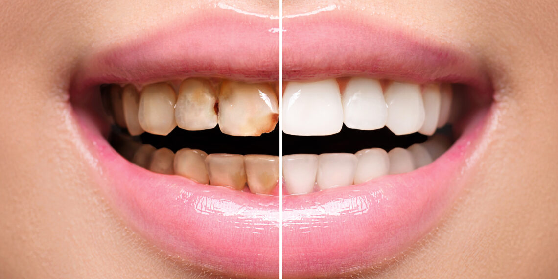 Top 5 Tips for a Better Smile