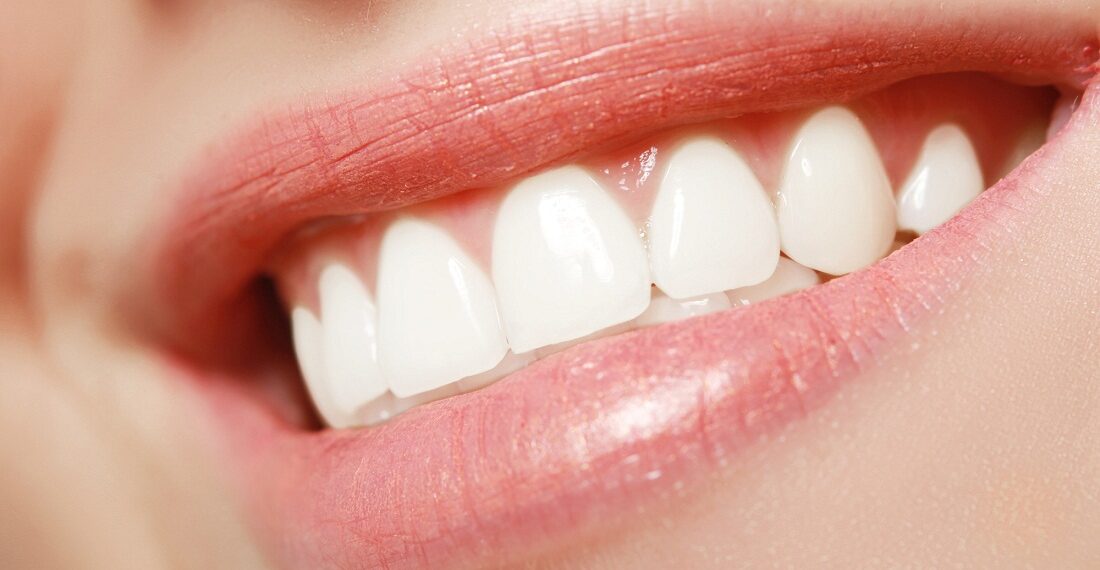 5 Effective Tips for Healthy Teeth and Gums
