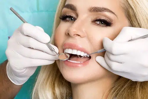 An In-Depth Overview of Dental Veneers