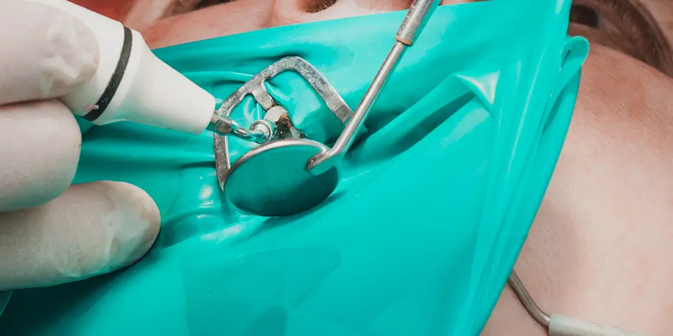 Rubber Dams for Dentists
