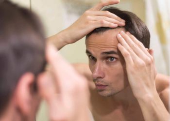 Thinking About a Hair Transplant? Here’s Why Melbourne Locals Choose FUE