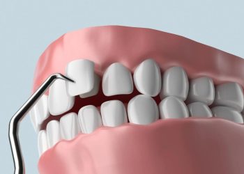 How Preventive Dentistry Safeguards Your Investment In A Smile Makeover
