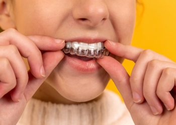6 Ways Clear Aligners Fit Into A Family Dentist’s Cosmetic Toolkit