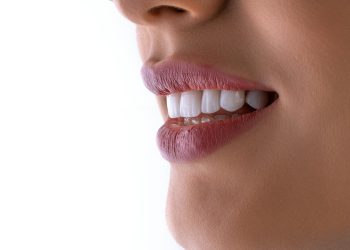 Cosmetic Dental